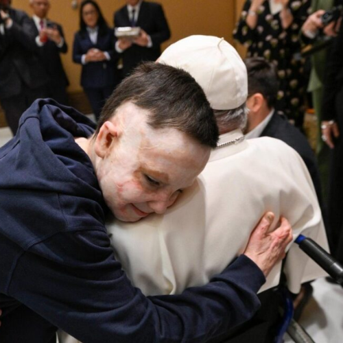 O comovente abraço do Papa Francisco com menino que traz no corpo as marcas da guerra