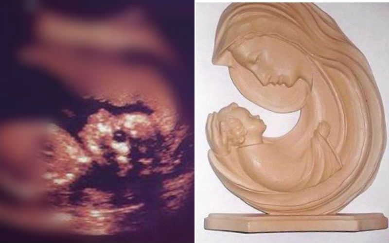 Imagem milagrosa de Nossa Senhora segurando bebê aparece em ultrassonografia