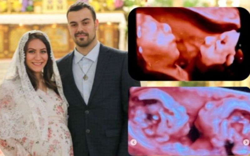 O testemunho de uma mãe católica grávida de gêmeos unidos pelo mesmo coração